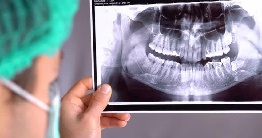 گرافی های دیجیتال دندان - تصویر شاخص
