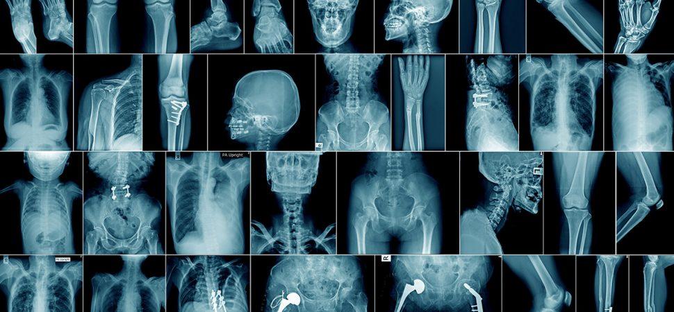 رادیولوژی چیست؟ - تصویر شاخص